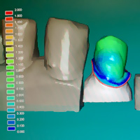 Cadcam